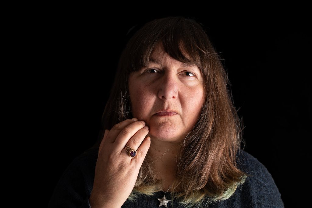 Senka Loosemore – Exposure Syndrome - 24 hours